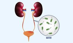 İdrar Yolu Enfeksiyonu Nedir?