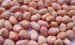 Hangisi daha sağlıklıdır; kaju fıstığı, fıstık veya badem?