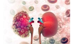 Böbrekler neden belirti vermeden yavaş yavaş hasar görür?