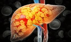 Yağlı karaciğer, sadece yaşam tarzı değişikliğiyle iyileştirilebilir mi?