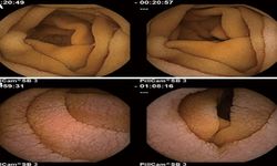 Aslında sağlıksız olan besinler hangileri?