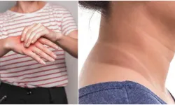 Bu belirtiyi biliyorsanız şaşırmayın.. Çünkü bu ölümcül bir hastalığın habercisi