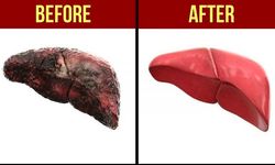 Karaciğeri detoksifiye eden en iyi 7 besin