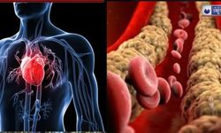 Damarlarınızda kirli kolesterol mü birikti ?