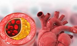 Damarları Doğal Yollarla Açmak İçin En İyi 7