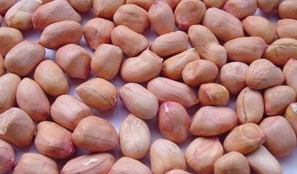 Hangisi daha sağlıklıdır; kaju fıstığı, fıstık veya badem?