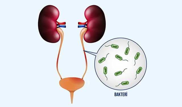 İdrar Yolu Enfeksiyonu Nedir?