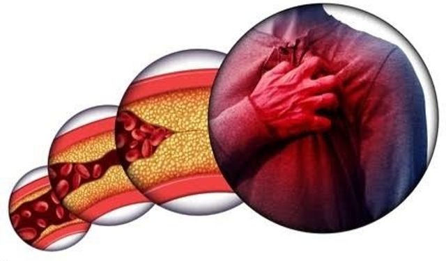 Kalp ve Damarları Tıkanmadan Önce Ortaya Çıkan 5 Belirti