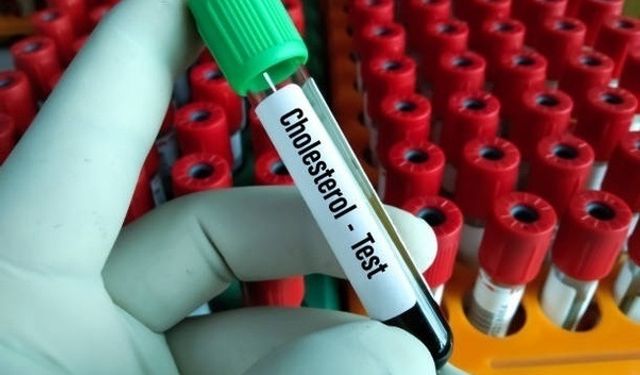 Kolesterolü düşüren içecekler nelerdir?