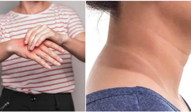 Bu belirtiyi biliyorsanız şaşırmayın.. Çünkü bu ölümcül bir hastalığın habercisi