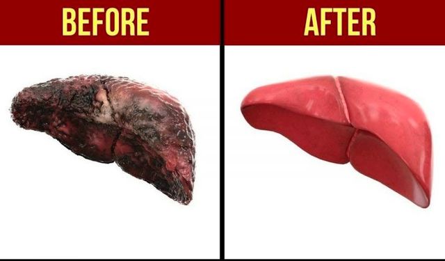 Karaciğeri detoksifiye eden en iyi 7 besin