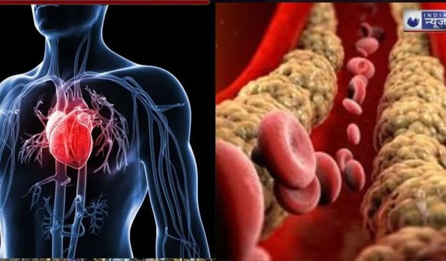 Damarlarınızda kirli kolesterol mü birikti ?