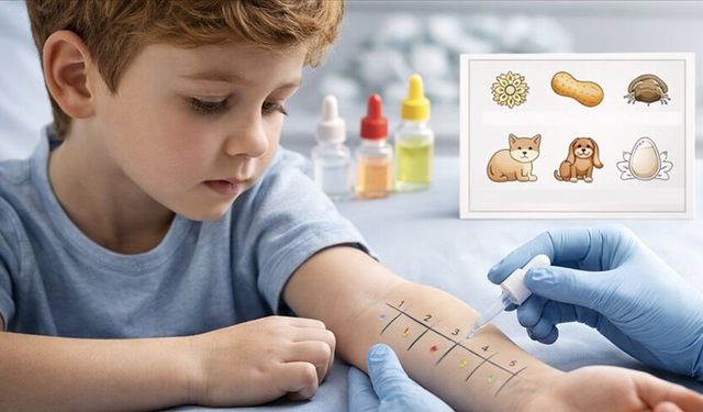 Her 20 çocuktan birinde 6 yaşına kadar gıda alerjisi görülebilir
