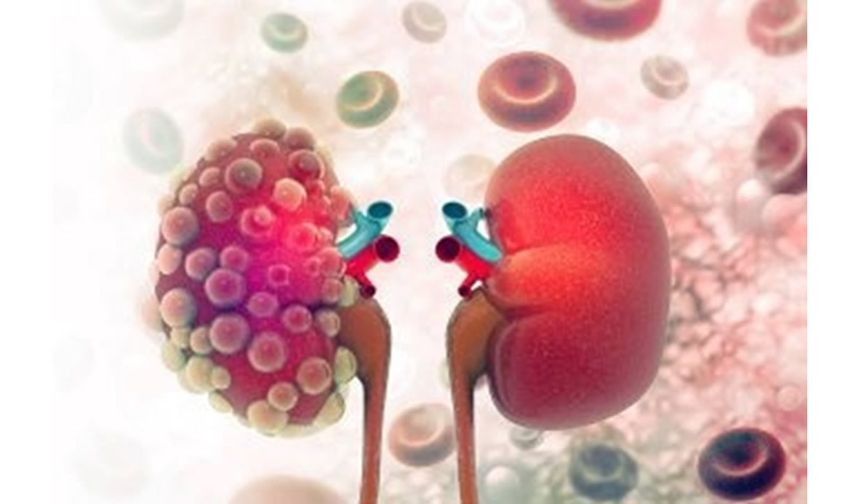 Böbrekler neden belirti vermeden yavaş yavaş hasar görür?