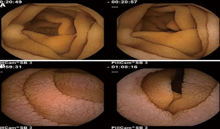 Aslında sağlıksız olan besinler hangileri?