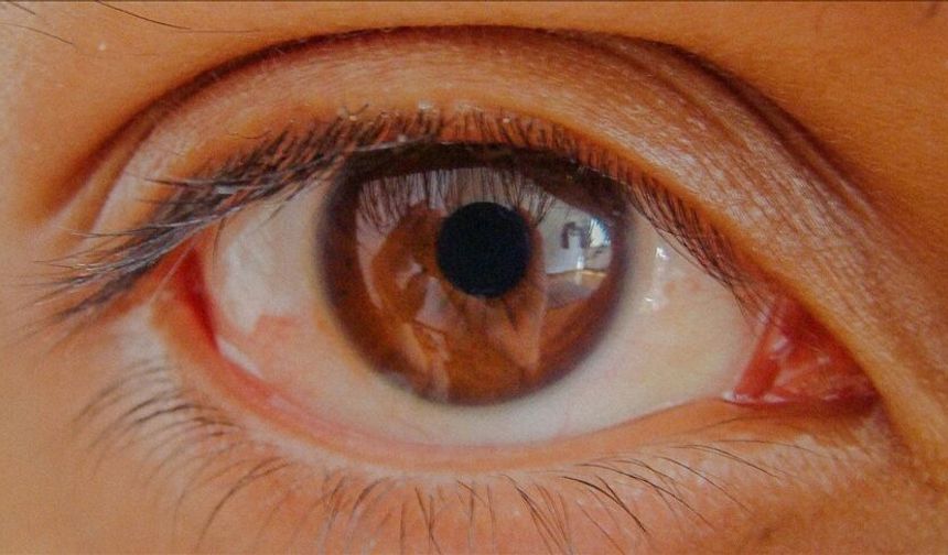 Göz tansiyonunda erken teşhis kalıcı körlüğün önüne geçiyor