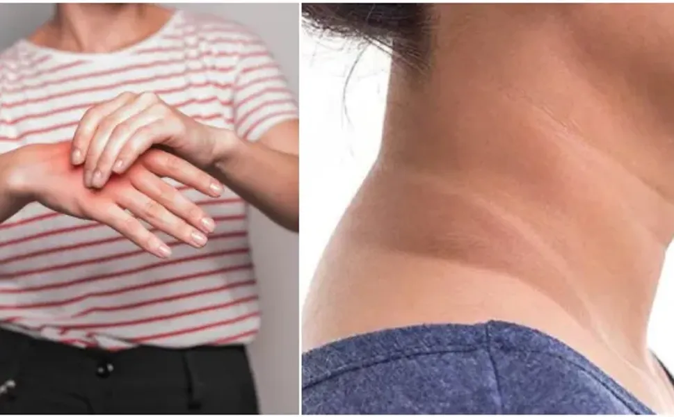 Bu belirtiyi biliyorsanız şaşırmayın.. Çünkü bu ölümcül bir hastalığın habercisi