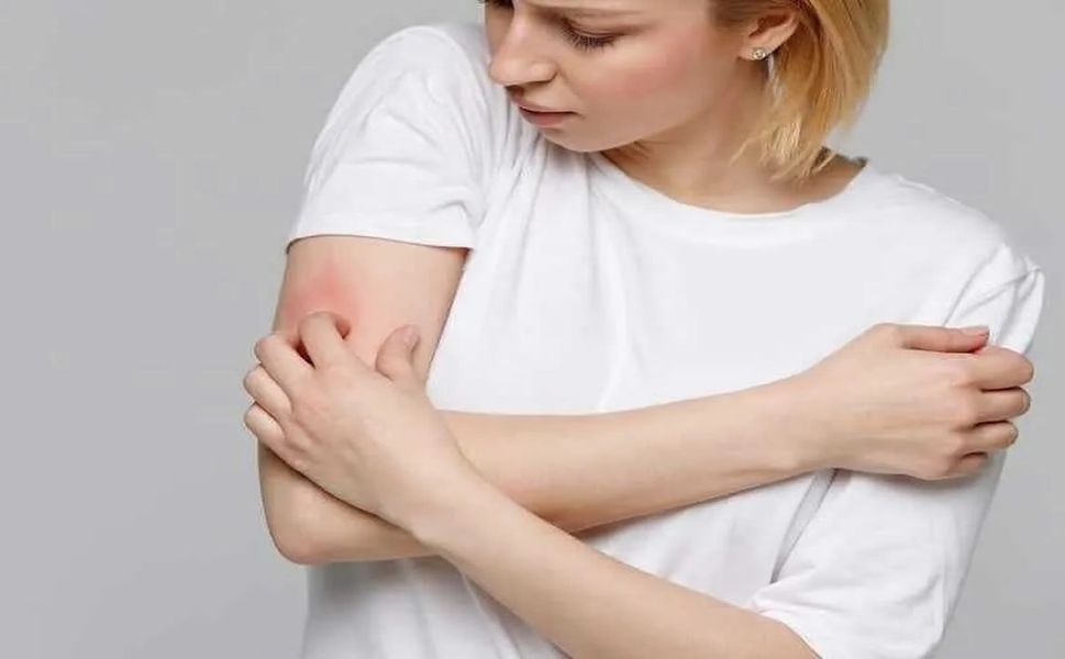 Kaşıntı Neden Olur? Kaşıntıya Ne İyi Gelir?