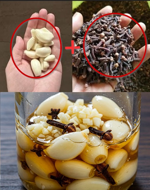 Bal Karanfil Sarımsak