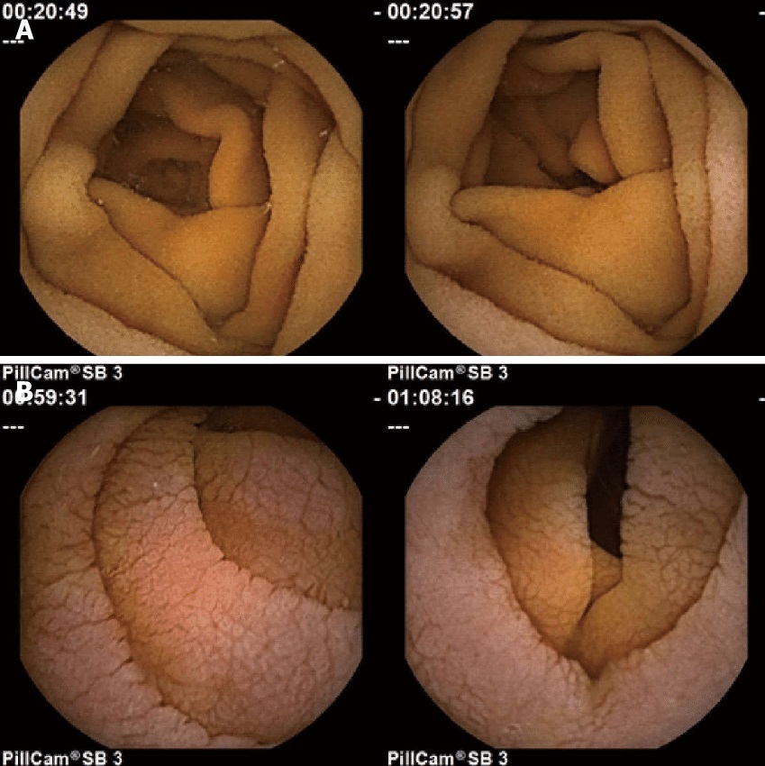 İnsanların Sağlıklı Olduğunu Düşündüğü Ama Aslında Sağlıksız Olan Besinler Hangileri