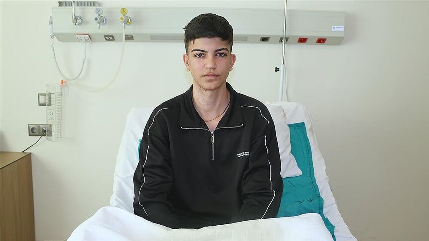 Vücudunun Yüzde 75'Inde Yanık Oluştu, 17 Ameliyatın Ardından Sağlığına Kavuştu